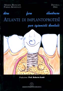 Implantoprotesi per l'igienista dentale