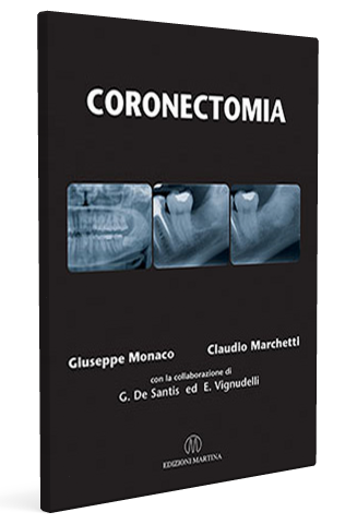 corenectomia