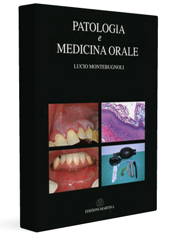 patologia-orale