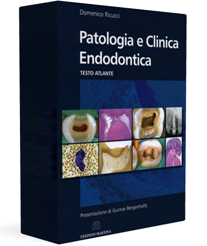 Patologia-clinica-endodontica