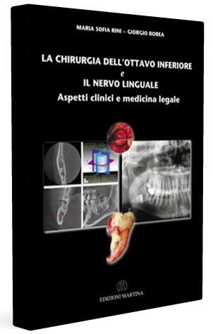 Chirurgia-ottavo-inferiore-nervo-linguale
