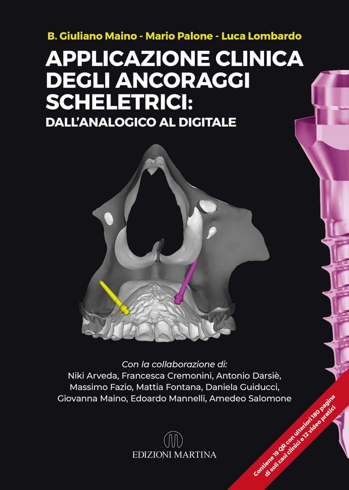 ancoraggi-scheletrici-maino-ortodonzia.2025