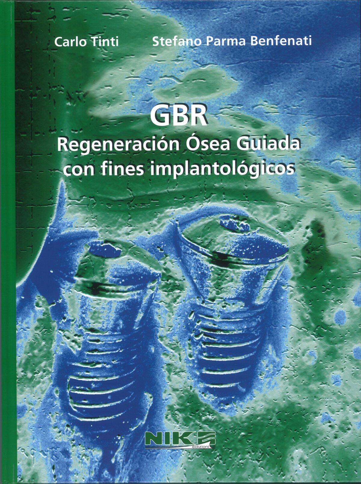 GBR-SPANISH