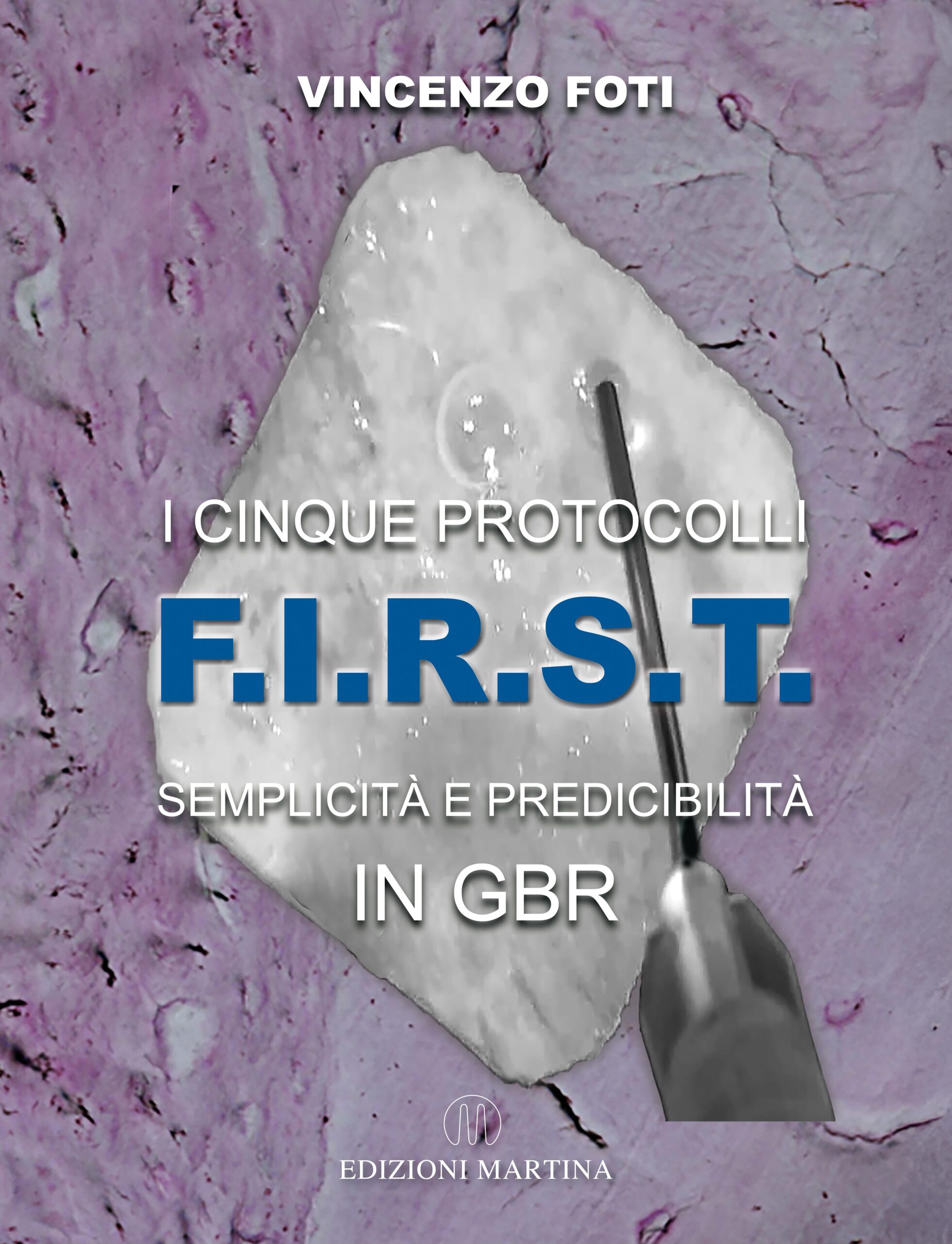 I CINQUE PROTOCOLLI F.I.R.S.T. SEMPLICITA' E PREDICIBILITA' IN GBR